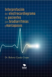 Interpretación del electrocardiograma de pacientes con bradiarritmias y marcapasos